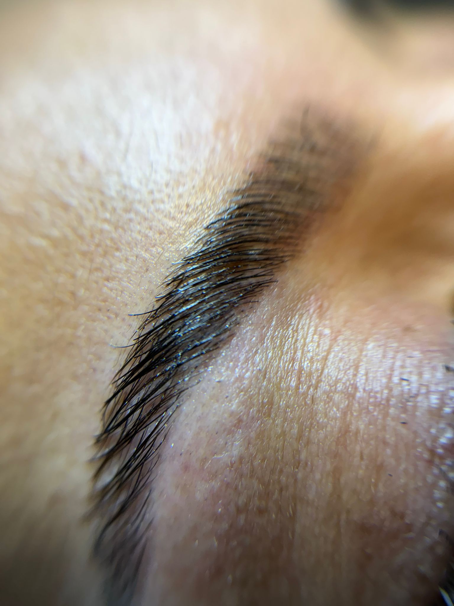 Browlift sourcils